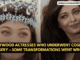 Bollywood Actresses Who Underwent Cosmetic Surgery – Some Transformations Went Wrong!